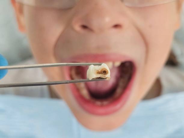 Best Weekend Emergency Dentist in Kensington, MD